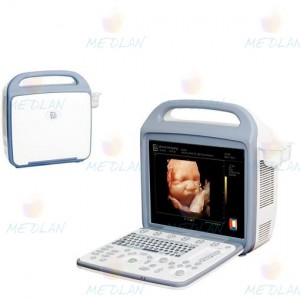 УЗ апарати: iuStar 160L